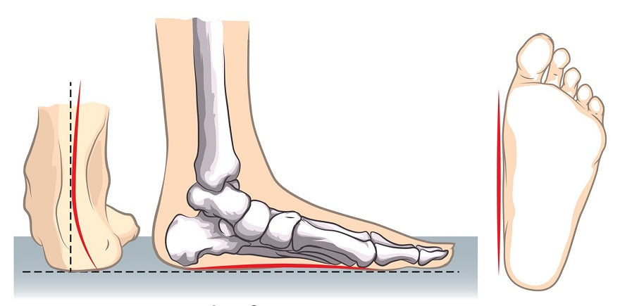 Insoles for flat feet