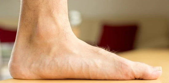 Medial view of a person's left foot with a flat arch